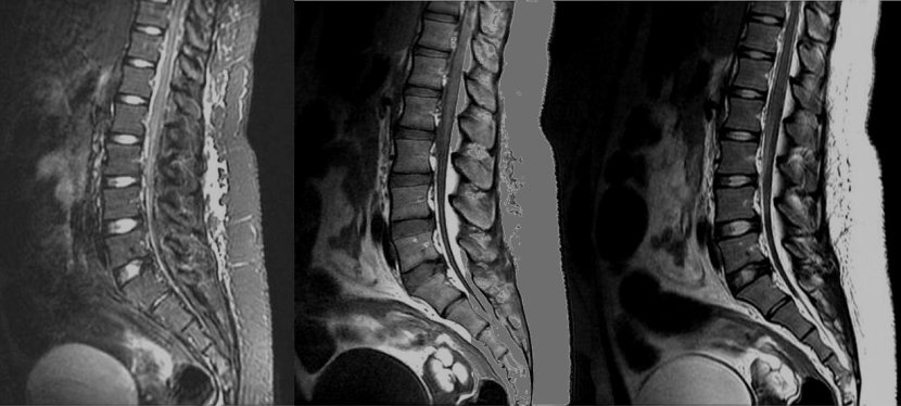 Les imageries médicales avancées, 2e&nbsp;partie.